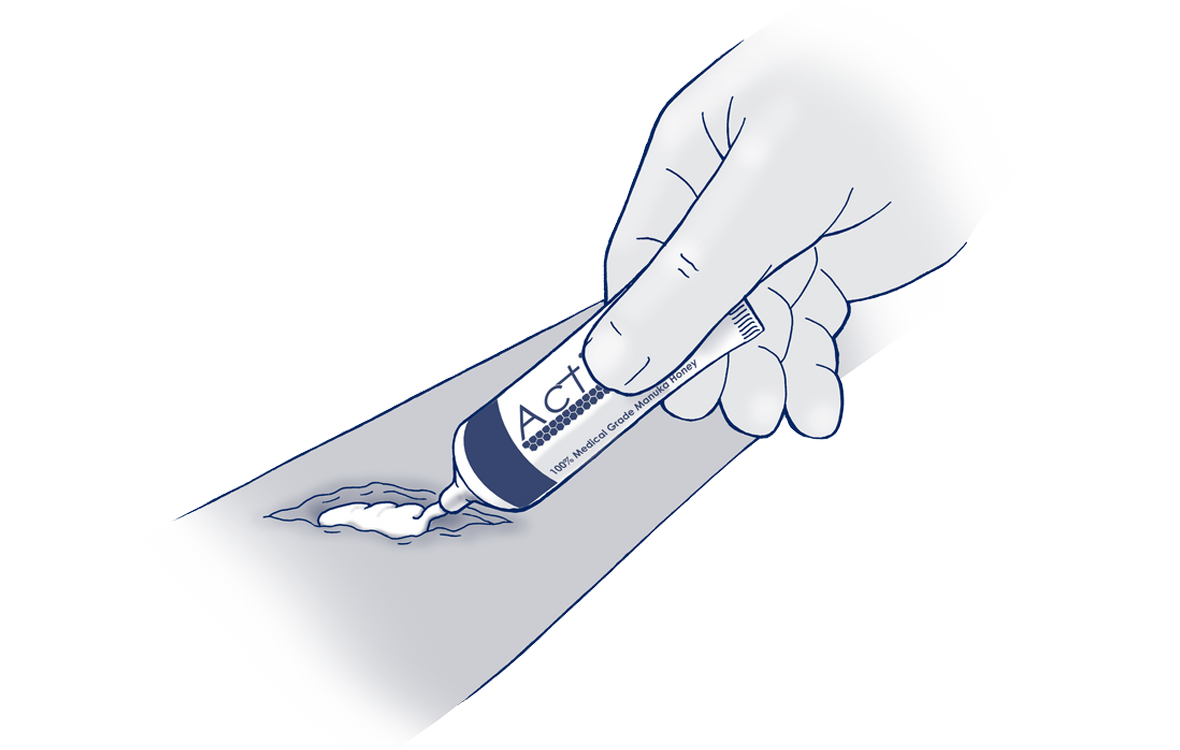 Applying Activion Tube