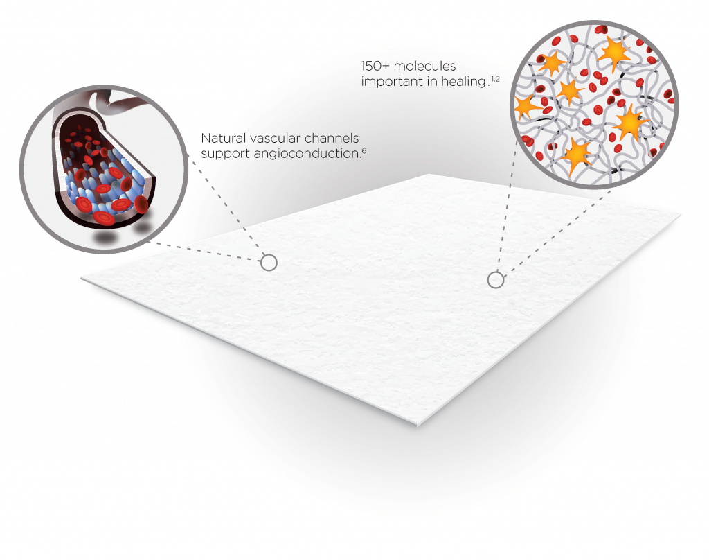 Endoform™ Antimicrobial and Endoform™ Natural Restorative Bioscaffold