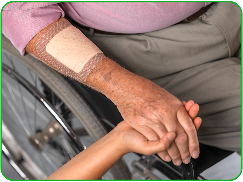 Mepilex® Family of Foam Dressings​